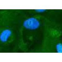 Actin-EGFP穩(wěn)轉(zhuǎn)細(xì)胞株，Hela